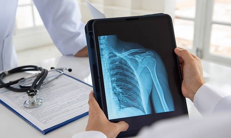 Lussazione della spalla - diagnosi