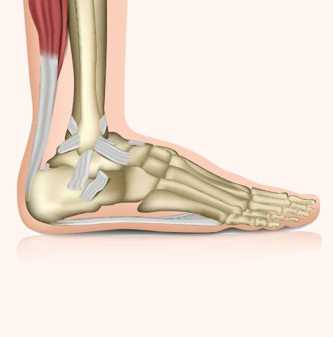 Distorsione alla caviglia