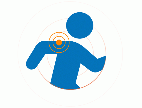 Dolori muscolari - sintomi