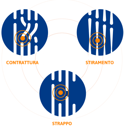 Contrattura Stiramento Strappo