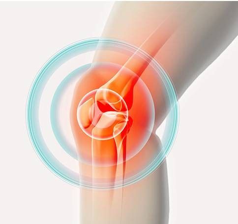 Tendinite al ginocchio - come riconoscerla