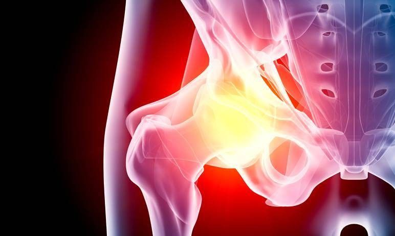 Radiografia cruralgia