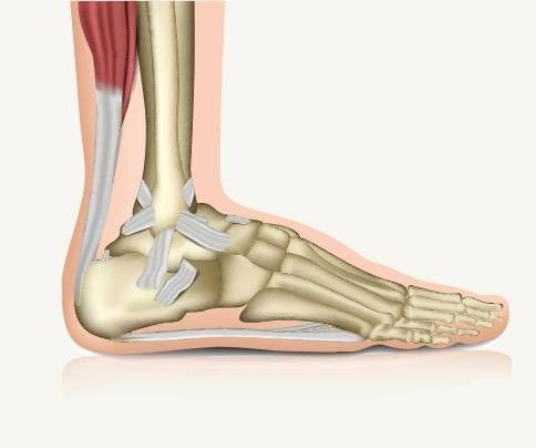 Tendinite piede - tendini robusti e sensibili