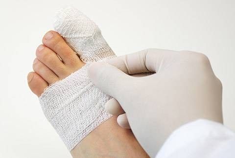 Alluce algo - terapia