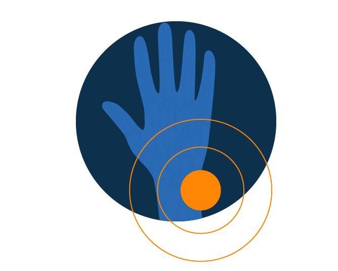 Distorsione al polso