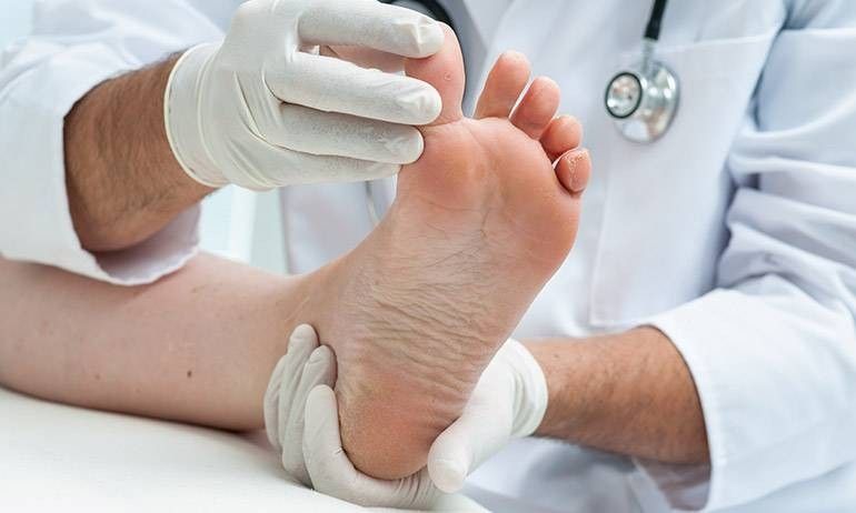 Alluce valgo - diagnosi